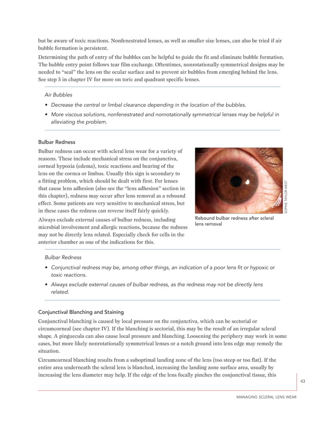 A guide to scleral lens fitting