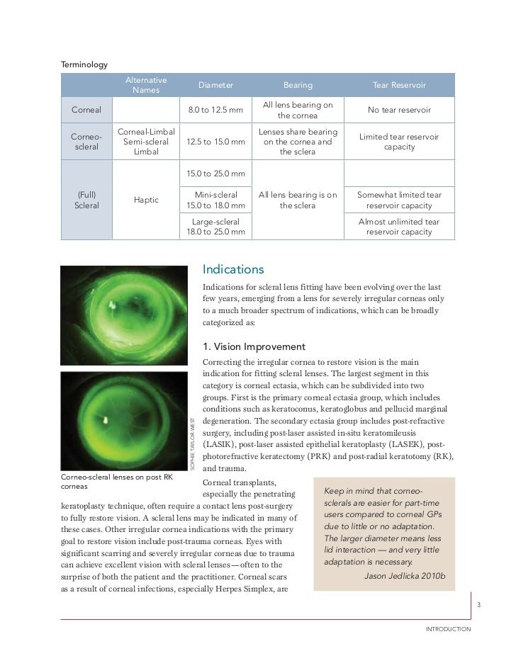 A guide to scleral lens fitting