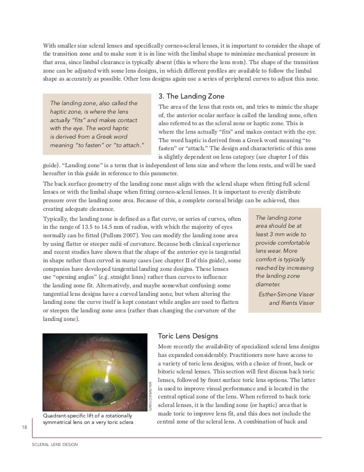 A guide to scleral lens fitting