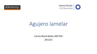 Agujero lamelar
Carme Macià Badia, MD PhD
24/1/21
 