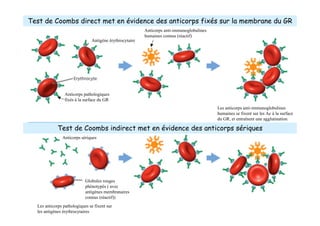 http://www.answers.com/topic/coomb-s-test
Test de Coombs direct
Test de Coombs indirect
Test de Coombs direct met en évidence des anticorps fixés sur la membrane du GR
Antigène érythrocytaire
Anticorps pathologiques
fixés à la surface du GR
Anticorps anti-immunoglobulines
humaines connus (réactif)
Les anticorps anti-immunoglobulines
humaines se fixent sur les Ac à la surface
du GR, et entraînent une agglutination
Test de Coombs indirect met en évidence des anticorps sériques
Anticorps sériques
Globules rouges
phénotypés ( avec
antigènes membranaires
connus (réactif))
Les anticorps pathologiques se fixent sur
les antigènes érythrocytaires
 