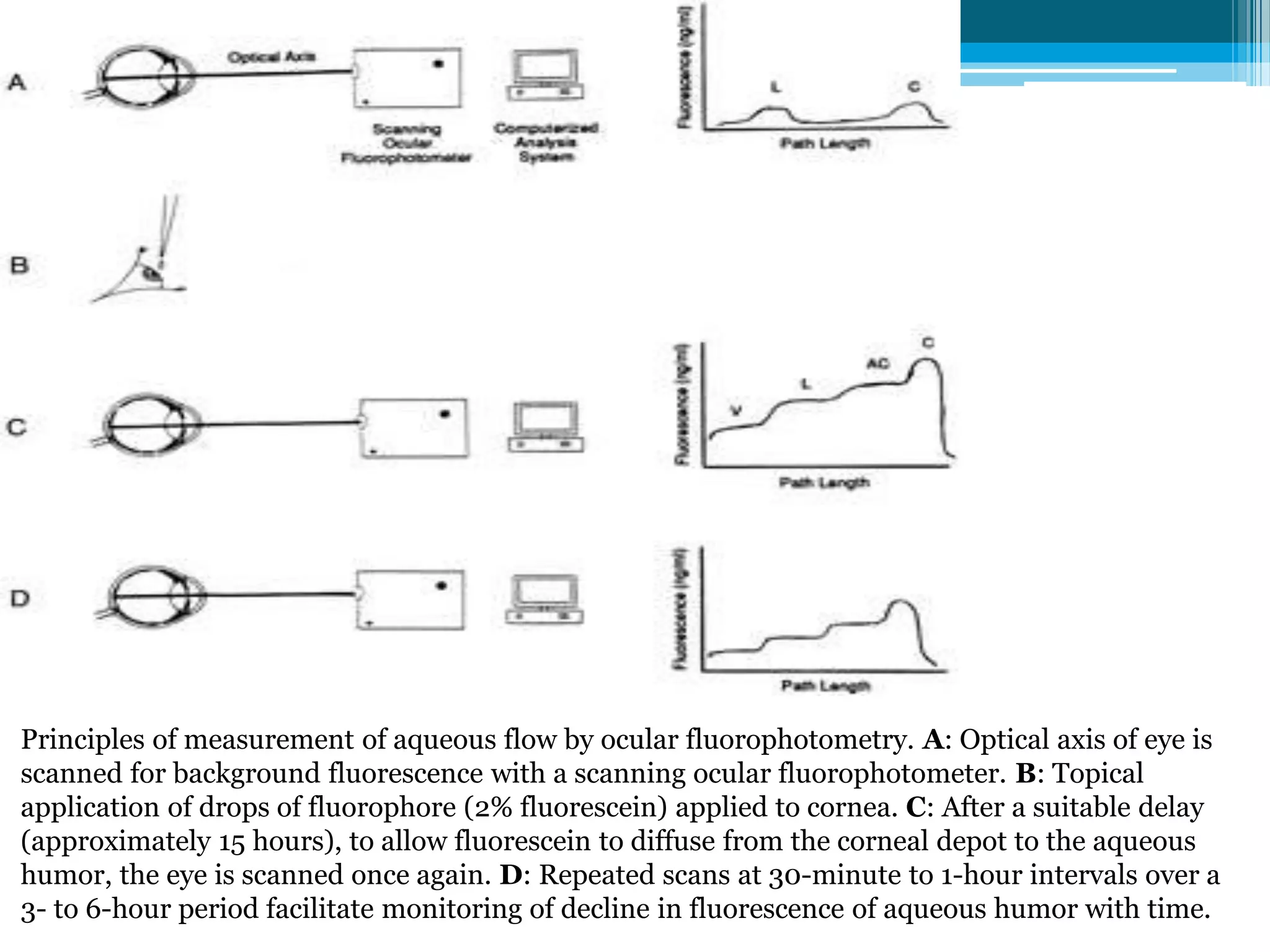 Principles of measurement of aqueous flow by ocular fluorophotometry. A: Optical axis of eye is
scanned for background fluorescence with a scanning ocular fluorophotometer. B: Topical
application of drops of fluorophore (2% fluorescein) applied to cornea. C: After a suitable delay
(approximately 15 hours), to allow fluorescein to diffuse from the corneal depot to the aqueous
humor, the eye is scanned once again. D: Repeated scans at 30-minute to 1-hour intervals over a
3- to 6-hour period facilitate monitoring of decline in fluorescence of aqueous humor with time.
 