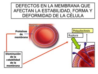 DEFECTOS EN LA MEMBRANA QUE AFECTAN LA ESTABILIDAD, FORMA Y DEFORMIDAD DE LA CÉLULA Proteínas de membrana Disminución de la estabilidad de la membrana Ruptura Poiquilocitosis 