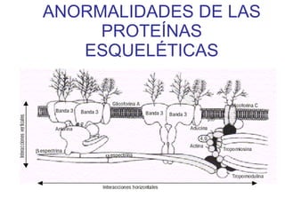 ANORMALIDADES DE LAS PROTEÍNAS ESQUELÉTICAS 