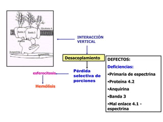 Desacoplamiento   DEFECTOS: Deficiencias: Primaria de espectrina Proteína 4.2 Anquirina Banda 3 Mal enlace 4.1 - espectrina INTERACCIÓN VERTICAL Pérdida selectiva de porciones esferocitosis Hemólisis  