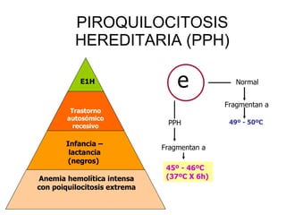 PIROQUILOCITOSIS HEREDITARIA (PPH) E1H Trastorno autosómico recesivo Infancia – lactancia (negros)  Anemia hemolítica intensa con poiquilocitosis extrema e Normal Fragmentan a 49º - 50ºC  PPH Fragmentan a 45º - 46ºC (37ºC X 6h) 