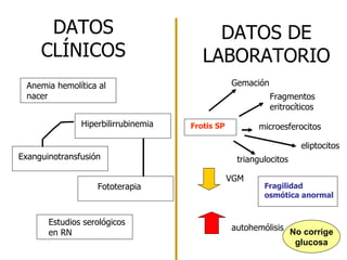 DATOS DE LABORATORIO DATOS CLÍNICOS Frotis SP Gemación  Fragmentos eritrocíticos microesferocitos eliptocitos triangulocitos VGM Fragilidad osmótica anormal autohemólisis No corrige glucosa Anemia hemolítica al nacer Hiperbilirrubinemia Exanguinotransfusión Fototerapia Estudios serológicos en RN 