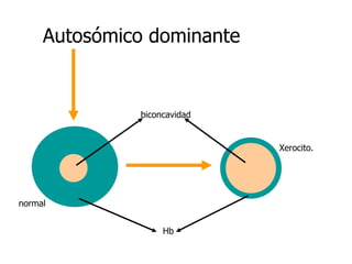 Autosómico dominante biconcavidad Hb Xerocito. normal 
