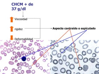 CHCM + de 37 g/dl Viscosidad rigidez Deformabilidad Aspecto contraído o espículado 