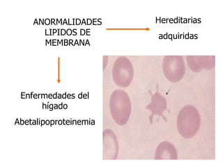 ANORMALIDADES LIPIDOS DE MEMBRANA Hereditarias adquiridas Enfermedades del hígado Abetalipoproteinemia 