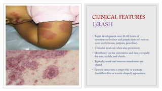 Acute Hemorrhagic edema of Infancy | PPTX