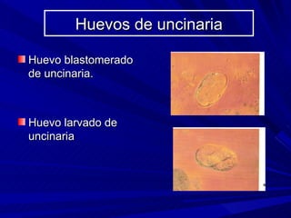 Huevos de uncinaria

Huevo blastomerado
de uncinaria.



Huevo larvado de
uncinaria
 