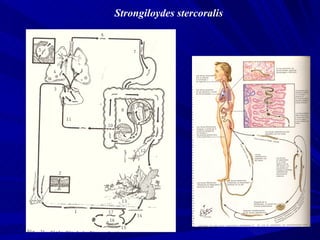 Strongiloydes stercoralis
 