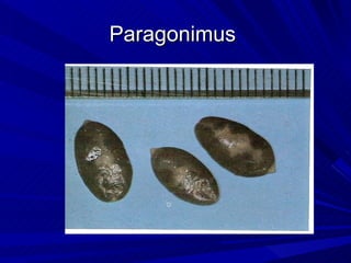 Paragonimus
 