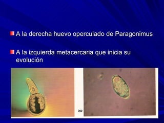 A la derecha huevo operculado de Paragonimus

A la izquierda metacercaria que inicia su
evolución
 