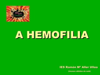 A HEMOFILIAA HEMOFILIA
(Imaxes obtidas da web)(Imaxes obtidas da web)
IES Ramón Mª Aller UlloaIES Ramón Mª Aller Ulloa
 