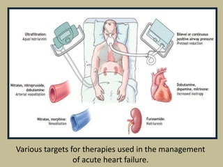 Various targets for therapies used in the management
of acute heart failure.

 
