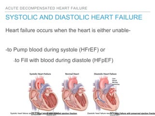 ACUTE DECOMPENSATED HEART FAILURE
SYSTOLIC AND DIASTOLIC HEART FAILURE
Heart failure occurs when the heart is either unable-
-to Pump blood during systole (HFrEF) or
-to Fill with blood during diastole (HFpEF)
Systolic heart failure results in heart failure with reduced ejection fraction. Diastolic heart failure results in heart failure with preserved ejection fractio
 