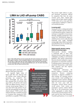 16 ASIAN HOSPITAL & HEALTHCARE MANAGEMENT ISSUE - 55, 2022
This increase might indicate an open,
and functional anastomosis affected
by competitive flow from the native
coronary artery. Here, surgical graft
revision will not likely improve baseline
TTFM values such as mean graft flow
or graft patency, resulting in a useless or
even harmful procedure.
Is snaring safe?
Snaring the LAD is a widespread method
to obtain a bloodless operative field, and
is well tolerated by patients. Indeed, this
technique is comparable to intracoronary
shunting regarding postoperative heart
enzyme rise. Atherosclerotic plaques or
calcified coronary arteries make shunting
technically more tough. Prolonged
snaring might induce blood vessel injury,
and arrhythmias, but are reversible up to
20-30 minutes of snaring.
Patient-specific decision making
before and during surgery
Patient-specific decision making
is performed daily in heart team
discussion between cardiac surgeons and
cardiologists according to international
guidelines. Here patient characteristics
determine decision making for a surgical,
percutaneous or conservative treatment.
Combining patient characteristics with
procedural characteristics could further
tailor treatment and thus improve
outcomes for patients.
Professional information for
decision making is scattered. Direct
comparison between competing
treatments or diagnosis modalities is
often lacking. For assessing coronary
artery stenosis, visual eyeballing by a
cardiologist is most common, although
high intra-and inter-observer variability
exists for many years with low
concordance around clinical relevant
cut-off points. Some centres use
quantitative coronary analysis (QCA)
with 2D or 3D reconstruction using
cardiac angiography to analyse degree
of stenosis for research purposes, but are
rarely used for heart team discussions.
To predict graft patency, it is no match
initial bypass graft, arterial grafts were
placed to other parts of the heart.
As expected, higher values of
bypass graft flow were observed with
the coronary artery snared, effectively
preventing any competitive flow.
More interestingly, the mean graft
flow increased from 20 mL/min with
open LAD to 30 mL/min with snared
LAD and differed between severity of
coronary stenosis groups (Figure 1). In
more than half of the patients (52 per
cent) the mean graft flow was lower than
clinical relevant TTFM cut-off values
with the LAD open. Graft flow increased
in 16 patients after snaring the LAD,
and shifted to acceptable TTFM values.
Adequate intraoperative
quality control improves
patients postoperative
quality of life, reduces
life-events such as
myocardial infarctions or
unnecessary graft revisions,
and therefore reduces
hospital costs of prolonged
treatments.
Figure 1: Mean LIMA graft flow (mL/min) increased with LAD snared compared to open LAD strati-
fied to degree of stenosis. A third of all patients shifted from a low mean graft flow ≤ 20 mL/min
with LAD open, to higher flows with LAD snared. Whiskers show the 25th and 75th percentile ±
1.5 times interquartile range in the Tukey box‐and‐Whiskers plot. LAD, left anterior descending
coronary artery; LIMA, left internal mammary artery.
MEDICAL SCIENCES
 