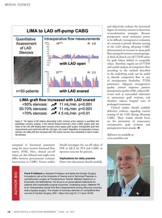 18 ASIAN HOSPITAL & HEALTHCARE MANAGEMENT ISSUE - 55, 2022
compared to functional assessment
using the more invasive fractional flow
reserve (FFR). Here, clinical cut-off
values are also debated and might even
differ between percutaneous coronary
intervention or CABG. Future studies
Frank R Halfwerk is Assistant Professor and leads the Cardiac Surgery
Innovations Lab at the University of Twente and is Technical Physician in
cardiothoracic surgery at Thoraxcentrum Twente, Medisch Spectrum in
Enschede, the Netherlands. His focus is on personalized treatments for
patients with predictable surgical outcomes. Underlying study: Halfwerk FR
et al. Intraoperative transit time flow measurements during off-pump coronary
artery bypass surgery: The impact of coronary stenosis on competitive flow.
Journal of Cardiac Surgery, 2021. https://doi.org/10.1111/jocs.16103.
AUTHOR
BIO
should investigate the cut-off values of
FFR or QCA for PCI and CABG to
optimise outcome for patients.
Implications for daily practice
Heart time discussions should carefully,
and objectively evaluate the functional
degree of coronary stenosis to determine
revascularisation strategies. Because
preoperative visual estimation proves
to be difficult, intraoperative evaluation
of a stenosis is pivotal. Routine snaring
of the LAD during off-pump CABG
demonstrated an increase in mean graft
flow among all coronary stenosis groups.
A third of clinical cut-off TTFM values
for graft failure shifted to acceptable
values. Therefore, regular use of TTFM
and careful analysis of competitive flow
according to the method described
in the underlying study can be useful
to identify competitive flow in case
of intraoperative borderline TTFM
parameters. Adequate intraoperative
quality control improves patients
postoperative quality of life, reduces life-
events such as myocardial infarctions
or unnecessary graft revisions, and
therefore reduces hospital costs of
prolonged treatments.
Clinical studies should establish
definitive evidence regarding routine
snaring of the LAD during off-pump
CABG. These studies should focus
on the prevention of unnecessary
intraoperative graft revisions and
postoperative heart attacks.
References are available at
www.asianhhm.com
Figure 2: The degree of left anterior descending (LAD) coronary artery stenosis is quantified with
quantitative coronary analysis. A left internal thoracic/mammary artery (LIMA) bypass graft was
made on the LAD with beating heart coronary artery bypass graft surgery. Intraoperative graft flow
measurements were performed with the LAD open, and snared. Regardless of preoperative coronary
stenosis, the LIMA graft flow increased with LAD snared, but was more substantial in mild to moder-
ate stenoses.
MEDICAL SCIENCES
 