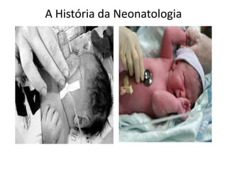 A História da Neonatologia
 