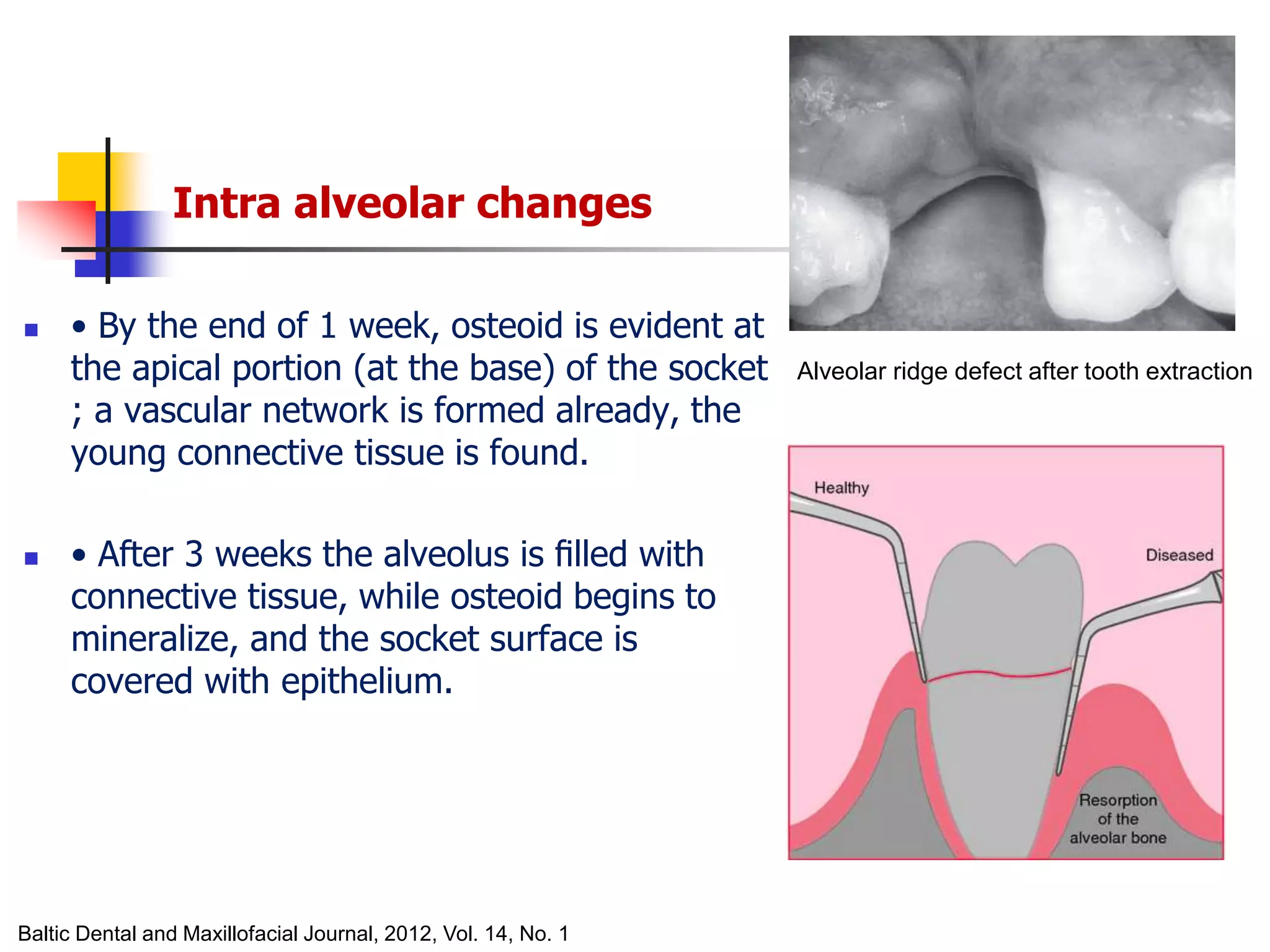 alveolar ridge expansion and socket preservation | PPT