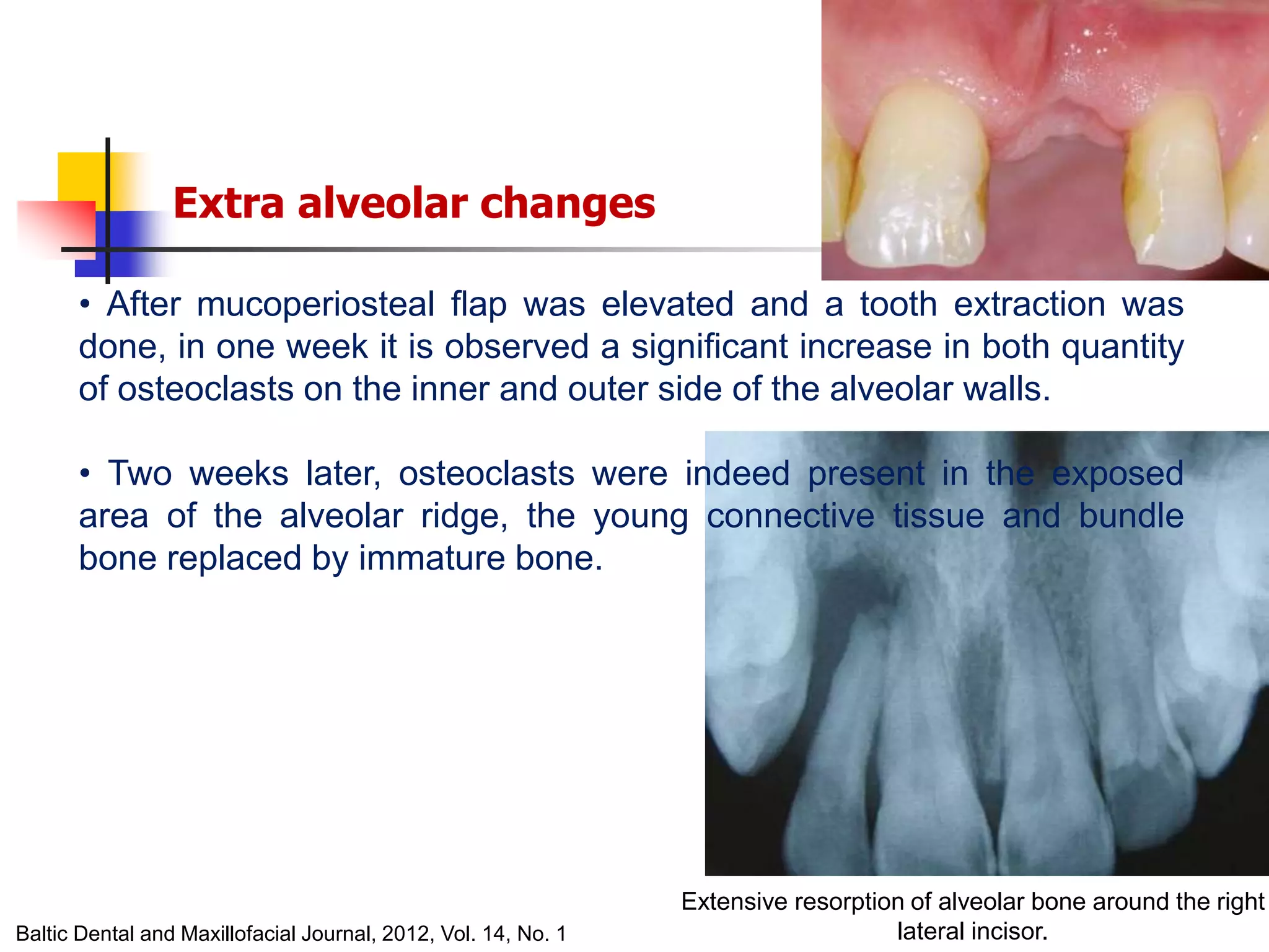 alveolar ridge expansion and socket preservation | PPT