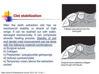 alveolar ridge expansion and socket preservation | PPT