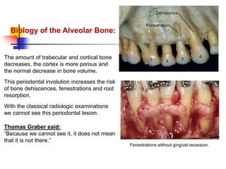 alveolar ridge expansion and socket preservation | PPT