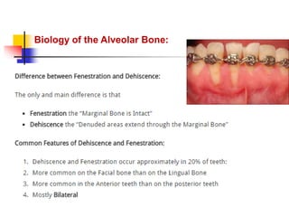 alveolar ridge expansion and socket preservation | PPT