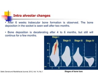 alveolar ridge expansion and socket preservation | PPT