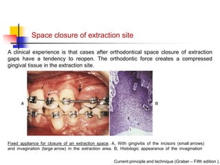 alveolar ridge expansion and socket preservation | PPT