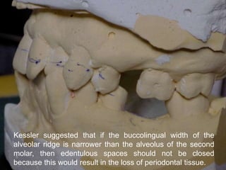 alveolar ridge expansion and socket preservation | PPT