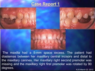alveolar ridge expansion and socket preservation | PPT