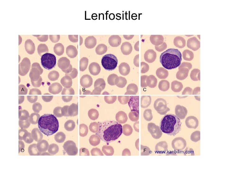 hematolojiyegiriş2 (fazlası için )