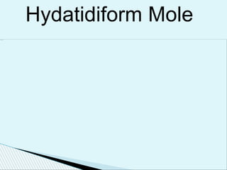 Hydatidiform Mole
 