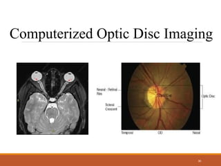 Computerized Optic Adult Health Nursing unit eye and ear part 2.ppt