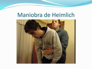 Maniobra de Heimlich
 