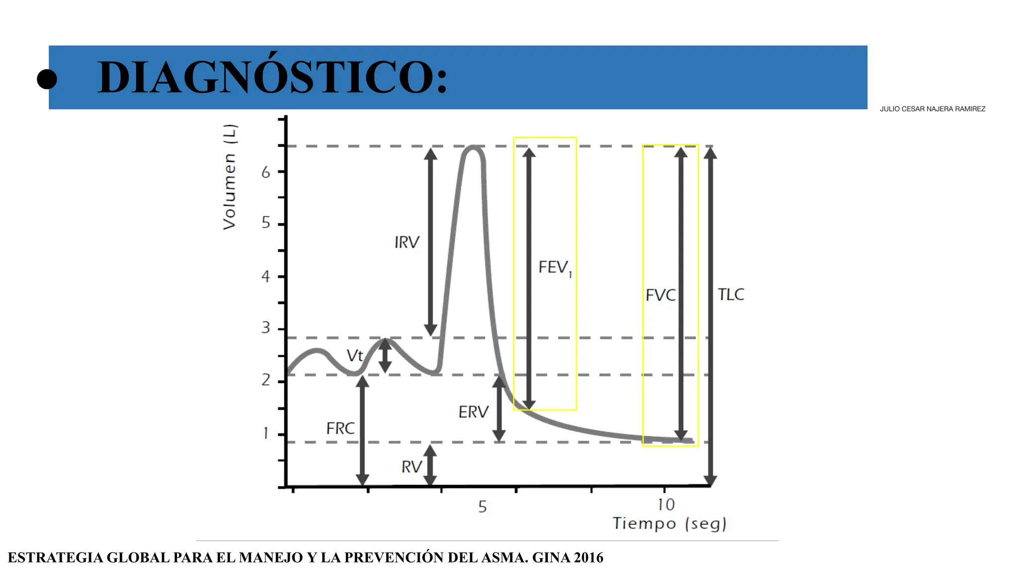 ● DIAGNÓSTICO:
ESTRATEGIA GLOBAL PARA EL MANEJO Y LA PREVENCIÓN DEL ASMA. GINA 2016
JULIO CESAR NAJERA RAMIREZ
 