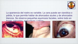 La apariencia del rostro es variable. La cara puede ser cianótica o
pálida, lo que permite hablar de ahorcados azules y de ahorcados
blancos. Se observa pequeñas equimosis faciales, sobre todo en
frente, párpados, conjuntivas y labios.
 