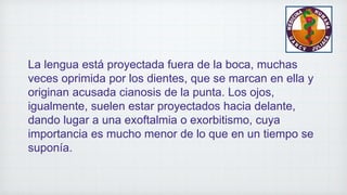 La lengua está proyectada fuera de la boca, muchas
veces oprimida por los dientes, que se marcan en ella y
originan acusada cianosis de la punta. Los ojos,
igualmente, suelen estar proyectados hacia delante,
dando lugar a una exoftalmia o exorbitismo, cuya
importancia es mucho menor de lo que en un tiempo se
suponía.
 