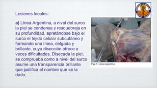 Lesiones locales:
a) Línea Argentina, a nivel del surco
la piel se condensa y resquebraja en
su profundidad, apretándose bajo el
surco el tejido celular subcutáneo y
formando una línea, delgada y
brillante, cuya disección ofrece a
veces dificultades. Disecada la piel,
se comprueba como a nivel del surco
asume una transparencia brillante
que justifica el nombre que se la
dado.
 