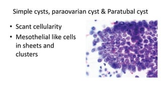 Shell Cyst Cell AHS-Ovarian tumor Cytology.pptx