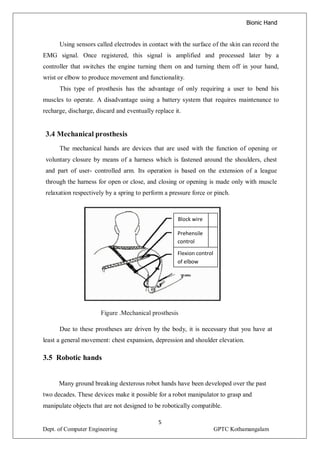 BIONIC HAND | PDF