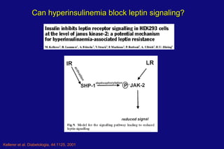 Kellerer et al. Diabetologia, 44:1125, 2001 Can hyperinsulinemia block leptin signaling? 