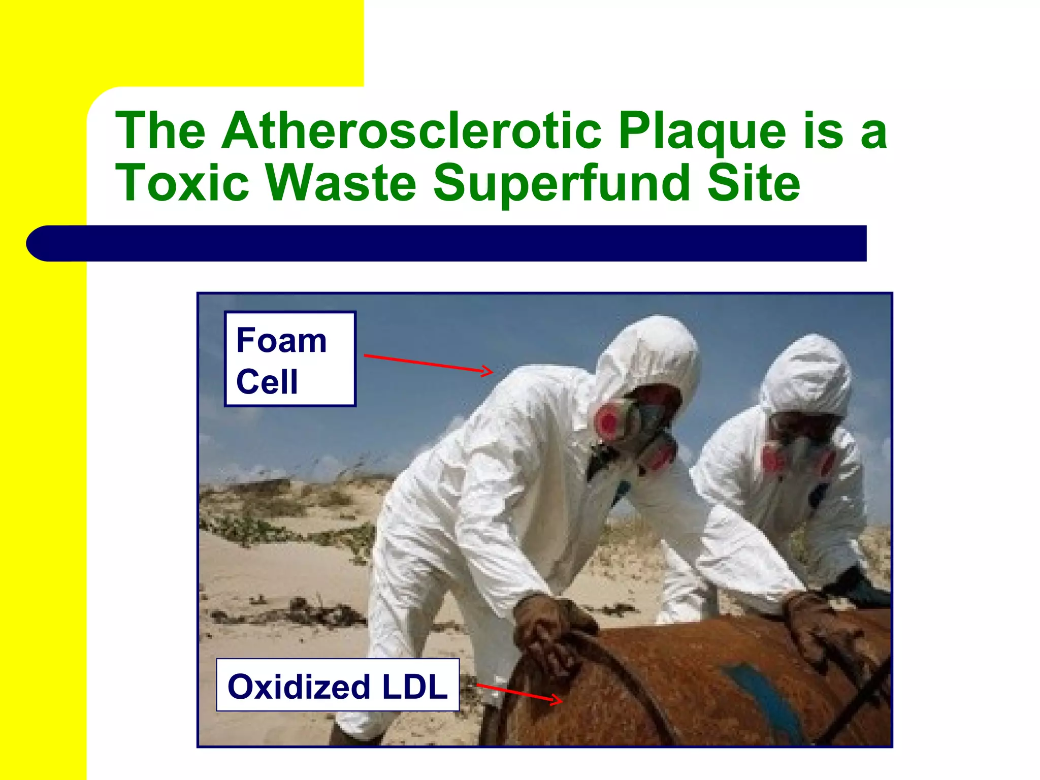 The Atherosclerotic Plaque is a Toxic Waste Superfund Site Foam Cell Oxidized LDL 