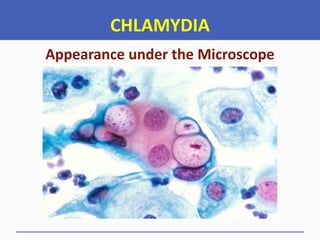 CHLAMYDIA
Appearance under the Microscope
 