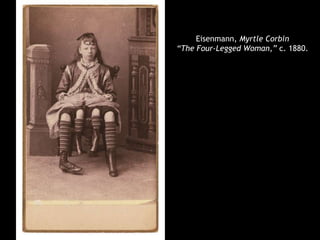 Eisenmann, Myrtle Corbin
“The Four-Legged Woman,” c. 1880.
 