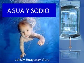AGUA Y SODIO




  Johssy Huayanay Viera
 