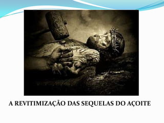 A REVITIMIZAÇÃO DAS SEQUELAS DO AÇOITE
 